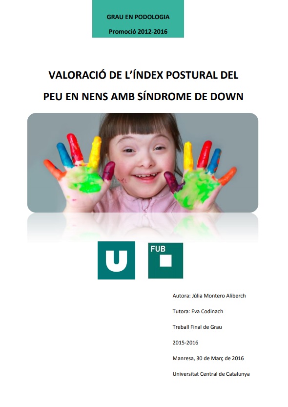 Valoració de l’índex postural del peu en nens amb Síndrome de Down (Grau en Podologia)